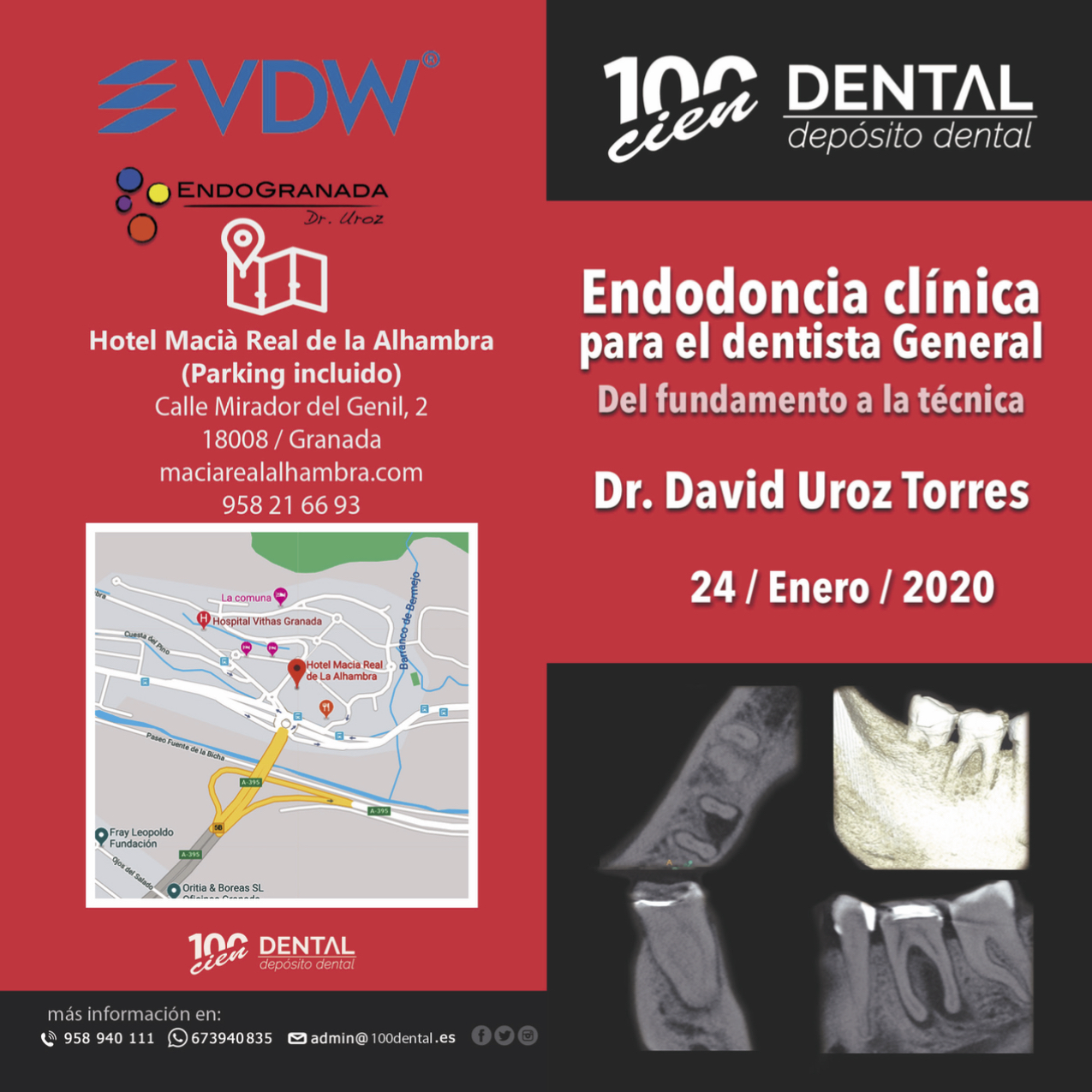 Curso impartido en Granada. Endodoncia clínica para el dentista general.